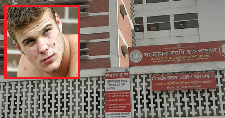 অবশেষে ঢাকায় মাঙ্কিপক্স সন্দেহভাজন তুরস্কের নাগরিক